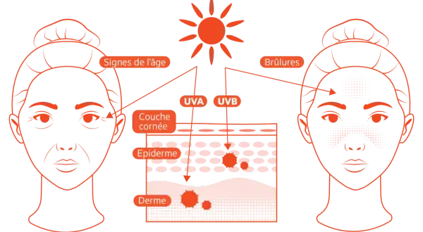Illustration montrant les effets des rayons UVA et UVB sur la peau : vieillissement prématuré et coups de soleil.