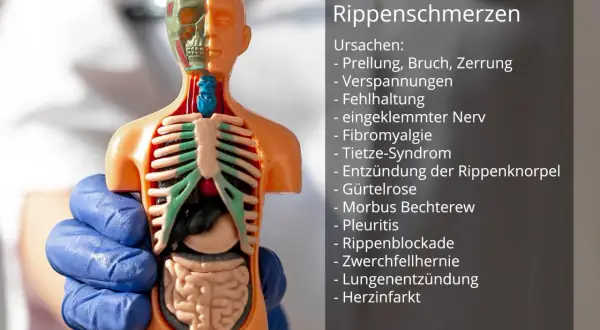 Anatomisches Modell zeigt Ursachen für Schmerzen Rippen links seitlich bei Bewegung, wie Prellung, Zerrung oder eingeklemmter Nerv.