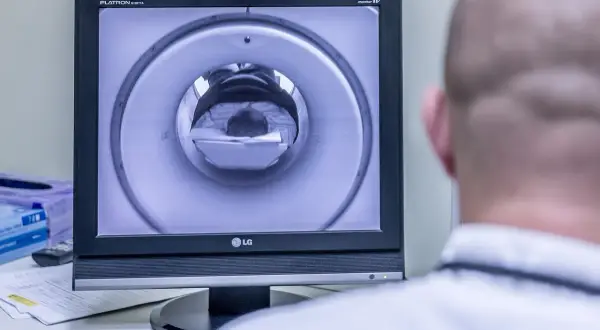 Monitor z obrazem rezonansu magnetycznego pacjenta wewnątrz aparatu.