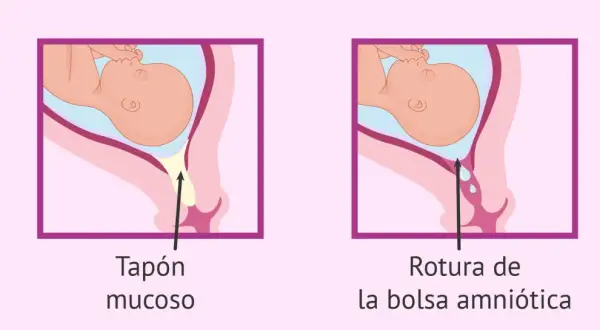 Ilustración comparativa: tapón mucoso y rotura de la bolsa amniótica, señales del parto en la semana 37.