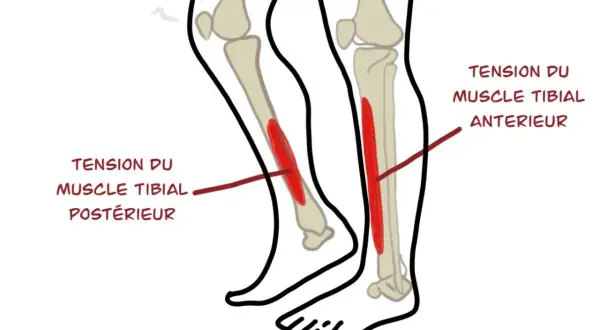 Schéma des muscles du tibia, montrant la tension du muscle tibial antérieur et postérieur, cause fréquente de mal au tibia.