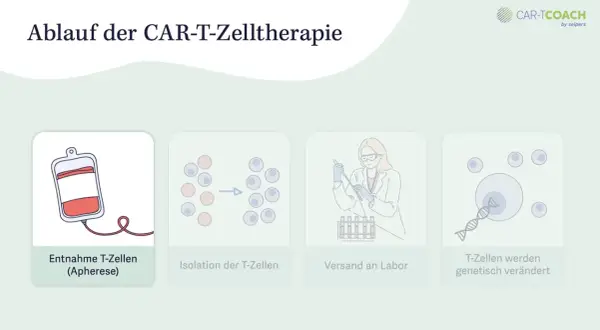 CAR-T-Zelltherapie voraussetzungen: Entnahme, Isolation, Versand ins Labor und genetische Veränderung von T-Zellen.