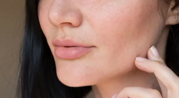 Nahaufnahme eines Gesichts mit vollen Lippen und leicht trockenen Wangen, die von einer Hand berührt werden.