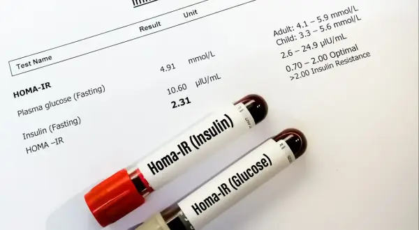 Wyniki badań HOMA-IR, kluczowe dla oceny insulinooporności. Dwa probówki z próbkami krwi.