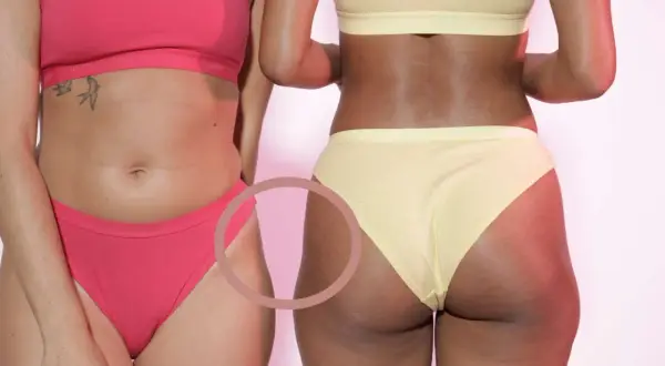 Deux femmes en sous-vêtements. La femme de droite, en jaune, montre des marques sur ses **hips dips**, une partie naturelle du corps.