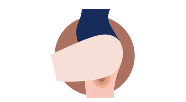 Illustration stylisée d'une partie du corps masculin, montrant la zone entre le testicule et l'anus.