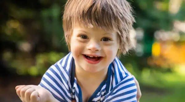 Un bambino sorridente con la sindrome di Down, con i suoi tratti distintivi, indossa una maglietta a righe blu e bianche.