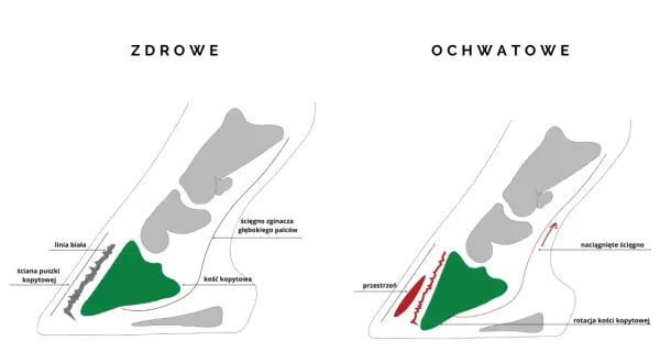 Zdrowe kopyto vs. ochwatowe: rotacja kości kopytowej i naciągnięte ścięgno przy zapaleniu kopyta konia.
