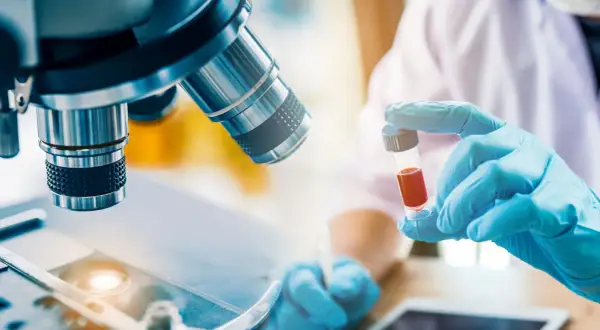 Forscher untersuchen Blutproben für die Immuntherapie bei Lungenkrebs. Ein Mikroskop und eine Ampulle mit roter Flüssigkeit sind zu sehen.