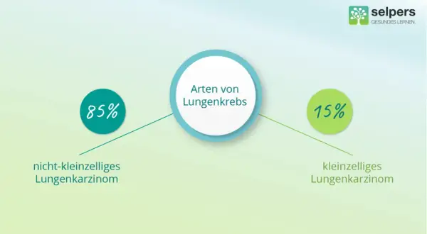 Grafik zeigt Lungenkrebsarten: 85% nicht-kleinzelliges Lungenkarzinom, 15% kleinzelliges Lungenkarzinom.