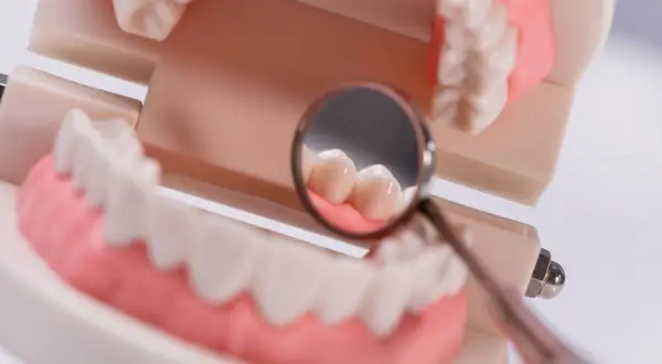Model szczęki z lusterkiem dentystycznym. Gdy boli zapalenie miazgi zęba, jak uśmierzyć ból?