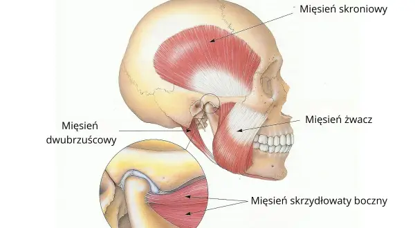 Anatomia żuchwy z zaznaczonymi mięśniami: skroniowym, żwaczem i skrzydłowatym bocznym. Powiększenie pokazuje staw skroniowo-żuchwowy, kluczowy przy bruksizmie objawy.