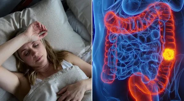 Frau im Bett, besorgt. Daneben eine 3D-Darstellung des Dickdarms mit einem Tumor, der zeigt, wohin Darmkrebs streut.