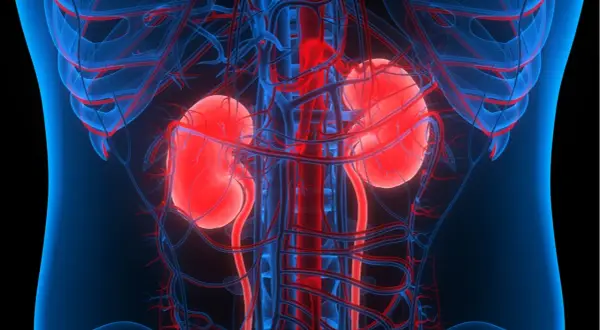 Anatomia nerek z widocznymi naczyniami krwionośnymi. Obraz może sugerować problemy z krążeniem lub zwapnienie nerek.