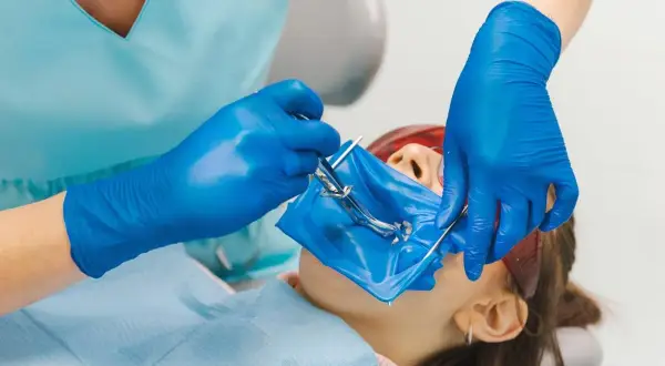 Dentysta zakłada koferdam pacjentowi, izolując pole zabiegowe.