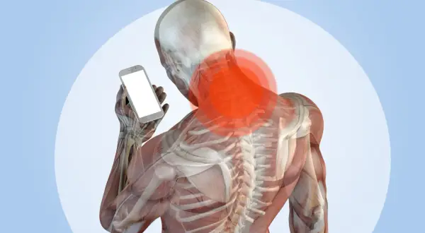 Anatomia del collo con aree rosse di dolore, che illustra il problema del "tech neck" causato dall'uso dello smartphone.