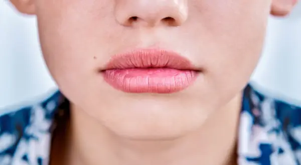 Gros plan sur une bouche aux lèvres légèrement gercées, d'une teinte rosée naturelle.