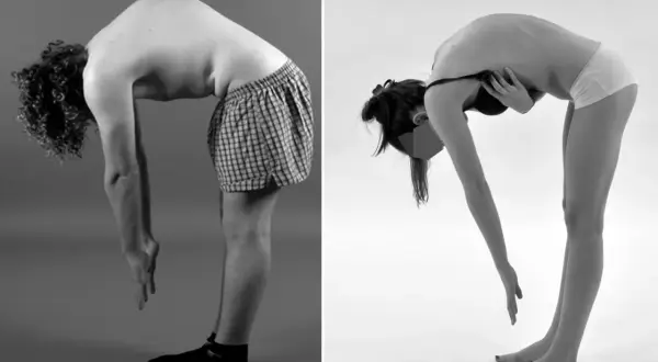 Comparaison avant/après d'une cyphose : un homme et une femme se penchent, montrant la courbure de leur colonne vertébrale.