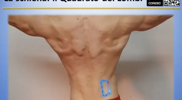 Vista posteriore di un uomo con evidenziate le fasce muscolari schiena, in particolare il quadrato dei lombi.