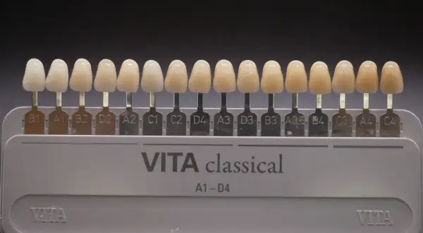 Scala VITA classical per la scelta del colore dei denti. Denti finti di varie tonalità per trovare la perfetta scala vita denti.