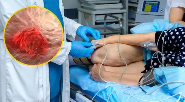 Zbliżenie na komórki raka jelita grubego obok pacjenta podłączonego do aparatury medycznej.