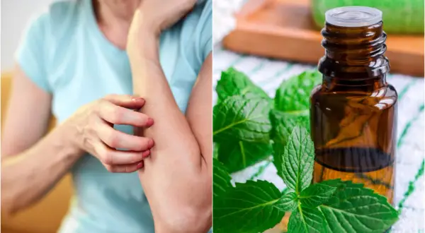Persona se rasca el brazo por picores en la piel. Al lado, un frasco de aceite esencial de menta y hojas frescas.