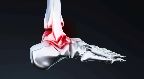 Illustration 3D d'une cheville, montrant la zone rouge de douleur et d'inflammation, essentielle pour la proprioception cheville.