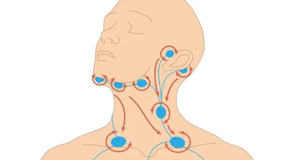 Illustration zeigt Lymphknoten im Halsbereich mit Pfeilen, die den Lymphfluss darstellen. Die Lymphknoten haben eine normale Größe.