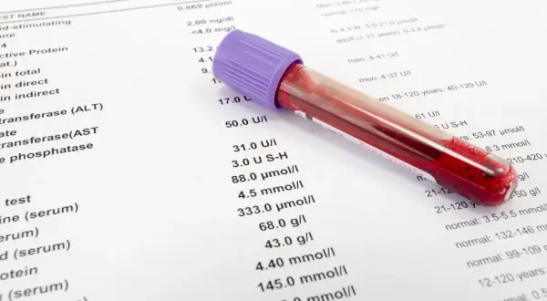 Wyniki badań krwi i probówka. Pokazują, ile ważne są wyniki badań dla oceny stanu zdrowia.