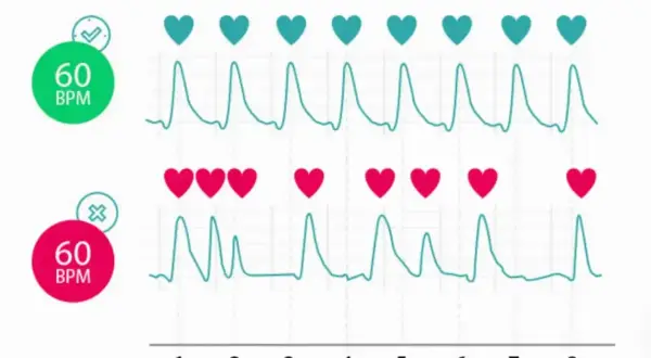Dwa wykresy EKG: górny z zielonym znacznikiem i 60 BPM, dolny z czerwonym i 60 BPM. Górny pokazuje regularne, zdrowe bicie serca, dolny nieregularne, sugerujące wysokie tętno.