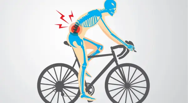 Skelett auf einem Fahrrad mit Schmerzsymbolen im unteren Rückenbereich, das auf Probleme mit der Fahrradergonomie hinweist.