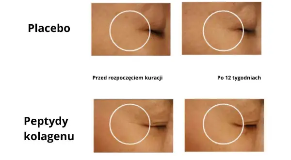 Porównanie efektów placebo i peptydów kolagenu na zmarszczki. Po 12 tygodniach widać różnicę, co odpowiada na pytanie po jakim czasie działa kolagen.