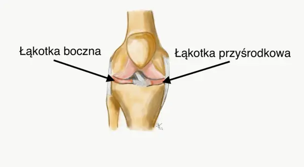 Ilustracja przedstawia budowę stawu kolanowego z zaznaczoną łąkotką boczną i przyśrodkową.