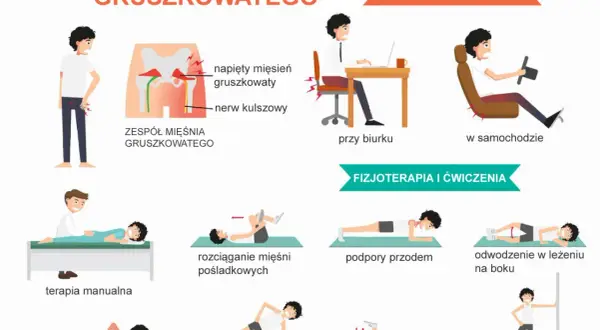 Ilustracja przedstawia zespół mięśnia gruszkowatego, jego objawy i ćwiczenia fizjoterapeutyczne.