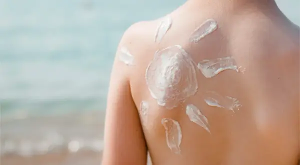 Sonnenschutz auf dem Rücken eines Kindes, geformt wie eine Sonne. Die astaxanthin wirkung schützt die Haut vor der Sonne.