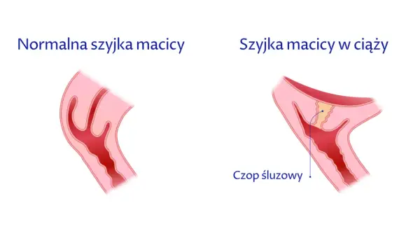 Czy krótka szyjka macicy ułatwia poród? Fakty, zagrożenia i porady dla kobiet w ciąży