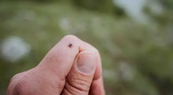En fästing på ett finger, en potentiell risk för borrelia hos barn.