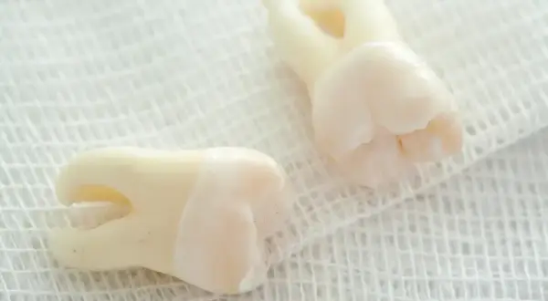 Palenie po dentyście: Uniknij suchego zębodołu! Ile czekać?
