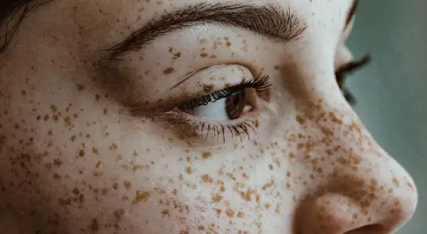 Zbliżenie na twarz z licznymi piegami, które przypominają naturalne piegi henna.