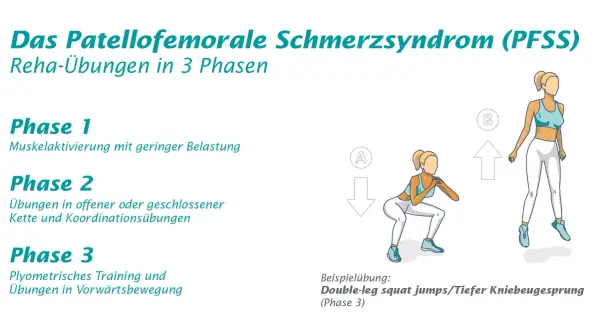 Reha-Übungen in 3 Phasen für das Patellofemorale Schmerzsyndrom (PFSS). Illustration zeigt eine Frau bei Kniebeugen und Sprüngen.
