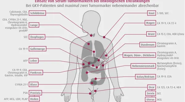 Schema zeigt Tumormarker wie CEA für verschiedene Organe, z.B. Lunge, Pankreas, Kolon/Rektum, zur Diagnose onkologischer Erkrankungen.