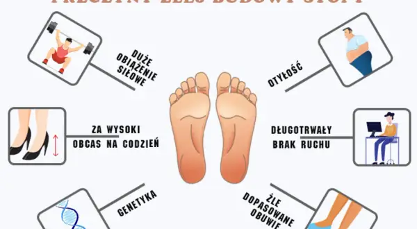 Centralnie umieszczona stopa ludzka, otoczona ikonami ilustrującymi przyczyny deformacji stóp: otyłość, obciążenie siłowe, wysokie obcasy, brak ruchu, genetyka i źle dopasowane obuwie.