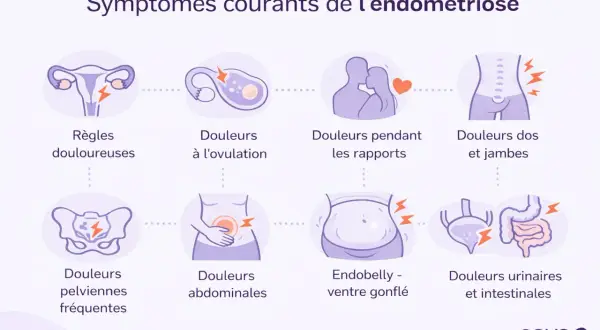 Symptômes courants de l'endométriose : règles douloureuses, douleurs à l'ovulation, douleurs pendant les rapports, douleurs dos et jambes, douleurs pelviennes, douleurs abdominales, endobelly, douleurs urinaires et intestinales.