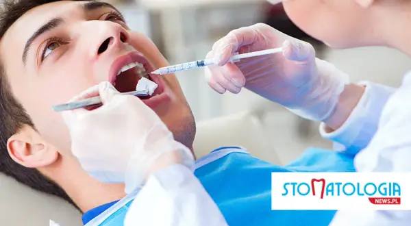 Jak szybko pozbyć się znieczulenia u dentysty? Sprawdzone rady