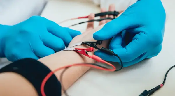 Badanie EMG, czyli elektromiografia, to badanie oceniające aktywność elektryczną mięśni. Na zdjęciu widać elektrody podłączone do przedramienia pacjenta.