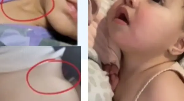 Urocza niemowlęca szyja, lekko schowana pod brodą, z widocznymi fałdkami.