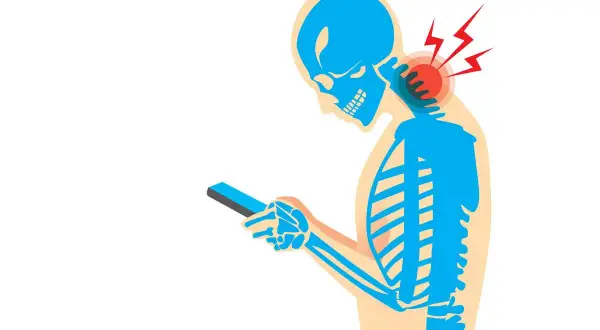 Squelette bleu regardant un téléphone, avec des éclairs rouges symbolisant les douleurs cervicales dues au stress.
