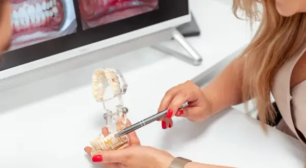 Dentystka omawia z pacjentem proces zakładania korony na zęba, używając modelu szczęki.