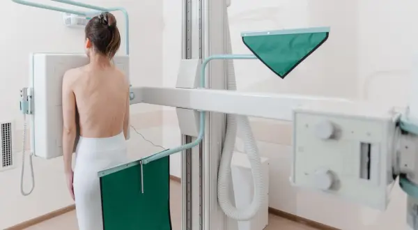 Kobieta stoi przed aparatem RTG, przygotowując się do badania. To właśnie RTG pozwala zajrzeć do wnętrza ciała.