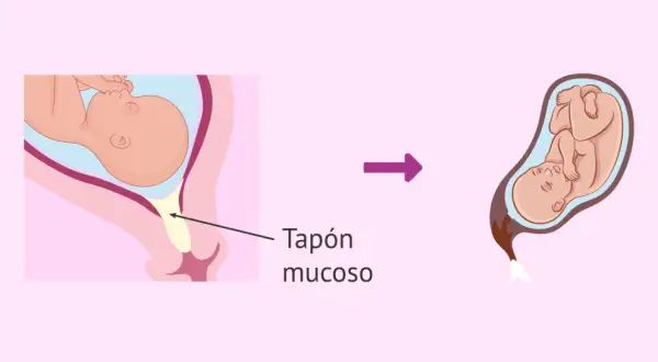Ilustración muestra un bebé en el útero y el tapón mucoso, seguido de un bebé listo para nacer.